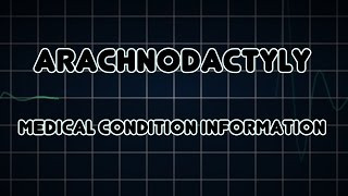 Arachnodactyly Medical Condition [upl. by Yrannav5]