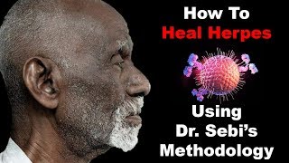 How To Heal Herpes  Using Dr Sebis Methodology [upl. by Letisha616]