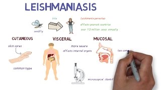 What is Leishmaniasis An introduction and overview [upl. by Ordnaxela]