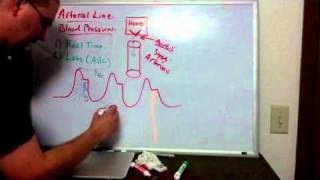 Haemodynamics Part 6 Arterial Line [upl. by Aihcila]