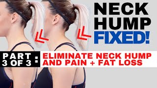 How to Get Rid of Neck Pain From Sleeping Wrong [upl. by Minda]