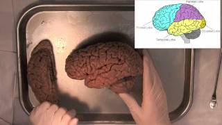 MIT Introduction to Neuroanatomy Series Part 1 [upl. by Vil289]