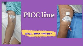 PICC Line Insertion  Patient Education video [upl. by Fachan]