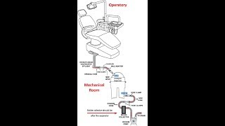 How do Amalgam Separators Work [upl. by Dehnel]