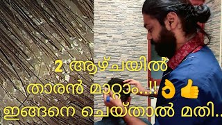 Part 1 ഇങ്ങനെ ചെയ്താൽ Dandruff താരൻ മുഴുവനായി മാറ്റാം Dandruff Treatment explained in Malayalam [upl. by Studnia]