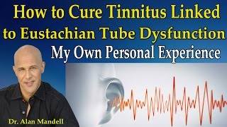 How to Cure Tinnitus Linked to Eustachian Tube Dysfunction My Personal Experience  Dr Mandell [upl. by Haymo]