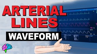 The Arterial Line Waveform EXPLAINED [upl. by Domph]