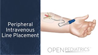 Peripheral Intravenous Line Placement by B Johnson L DelSignore  OPENPediatrics [upl. by Newra]