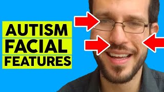 Autism Facial Feature  Aspergers Facial Characteristics [upl. by Eshman987]