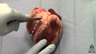 Sheeps Heart Dissection [upl. by Dachia]