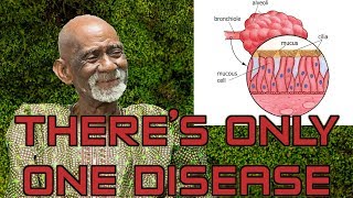 Dr Sebi Reveals Herbs For Mucus Removal [upl. by Sacttler]