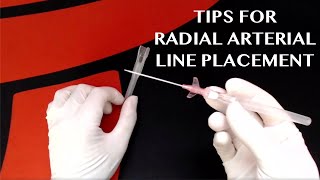 Tips For Radial Arterial Line Placement [upl. by Zetniuq580]