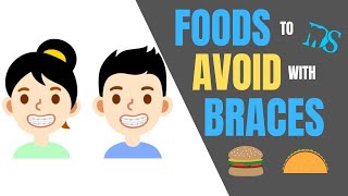 Foods To Avoid With Braces [upl. by Ahtebbat]