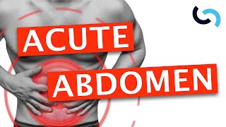 Acute Abdomen  Diagnosis and Management [upl. by Baram371]