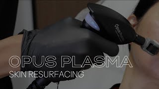 OPUS PLASMA SKIN RESURFACING [upl. by Neural]