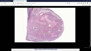 SVT 2nde  structure histologique de lovaire [upl. by Kcirad26]